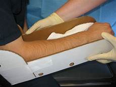Cardboard Splint