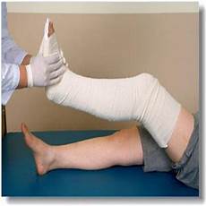 Cardboard Splint